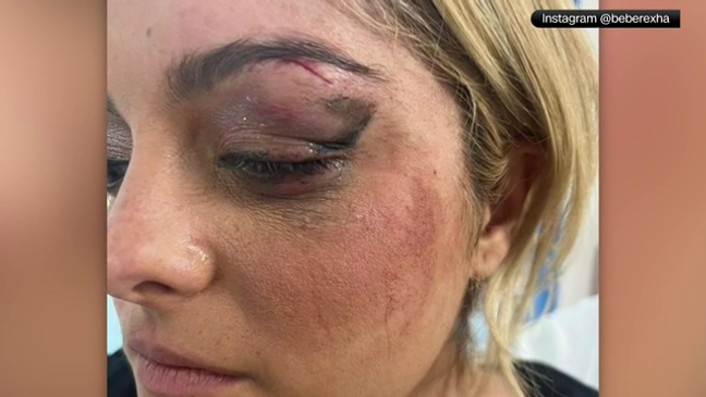 Bebe Rexha suffers black eye after she was hit by cellphone while performing on stage (CNN Newsource)